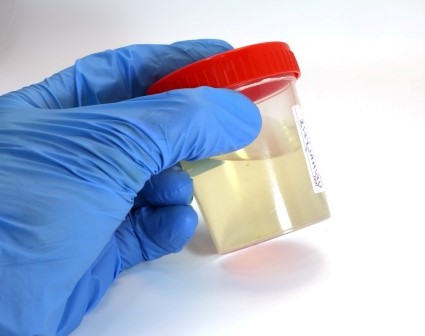 Synthetic Urine For Dot Physical Atlanta GA 30349